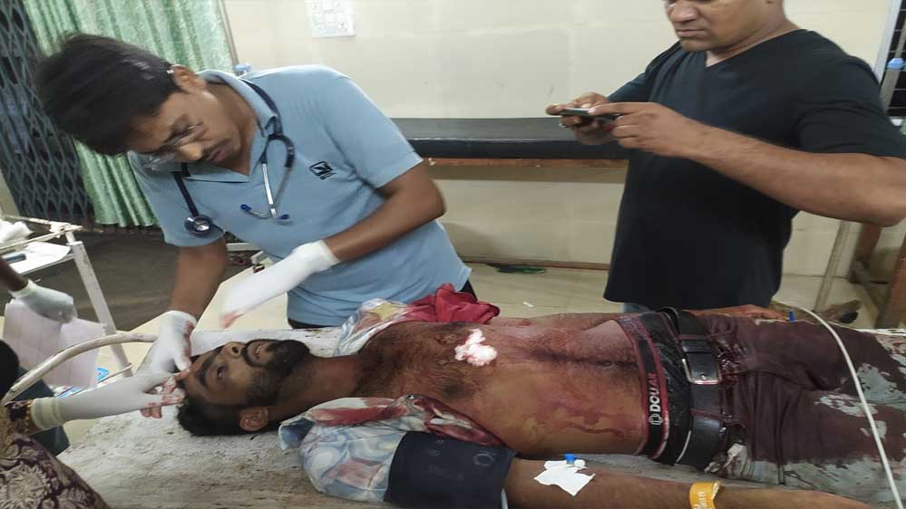 मनेंद्रगढ़ में 10 हमलावरों के ताबड़तोड़ चाकू के हमले से युवक की मौत